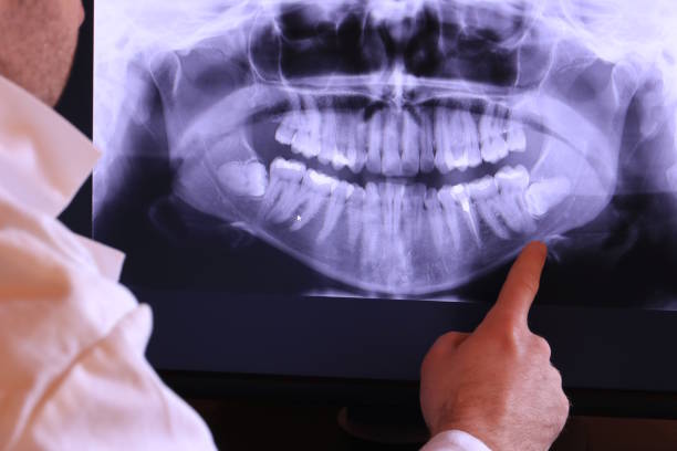 Best Emergency Treatment for Dental Infections or Abscesses in Gibbstown, NJ